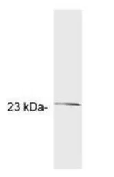 Anti-GCAP2 antibody [A1] used in Western Blot (WB). GTX25422