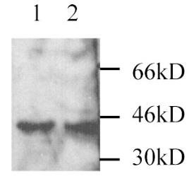 Anti-MEK3 antibody used in Western Blot (WB). GTX25428