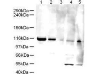 Anti-ATAD5 antibody used in Western Blot (WB). GTX25429