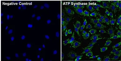 Anti-ATP5B antibody [4.3E8.D10] used in Immunocytochemistry/ Immunofluorescence (ICC/IF). GTX25432