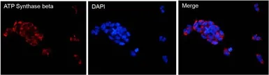Anti-ATP5B antibody [4.3E8.D10] used in Immunocytochemistry/ Immunofluorescence (ICC/IF). GTX25432