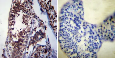 Anti-Hsp70 antibody [3A3] used in IHC (Paraffin sections) (IHC-P). GTX25439