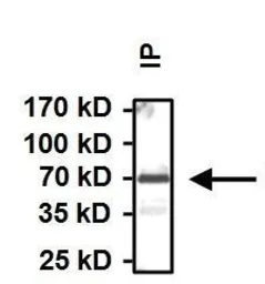Anti-Hsp70 antibody [3A3] used in Immunoprecipitation (IP). GTX25439