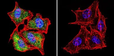 Anti-Hsp70 antibody [3A3] used in Immunocytochemistry/ Immunofluorescence (ICC/IF). GTX25439