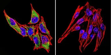 Anti-Hsp70 antibody [2A4] used in Immunocytochemistry/ Immunofluorescence (ICC/IF). GTX25442