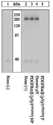 Anti-PDGF Receptor alpha + beta (phospho Tyr572/Tyr574) antibody used in Western Blot (WB). GTX25443