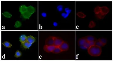 Anti-PDGF Receptor alpha + beta (phospho Tyr572/Tyr574) antibody used in Immunocytochemistry/ Immunofluorescence (ICC/IF). GTX25443