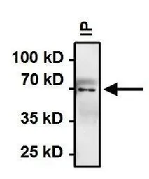 Anti-Hsp70 antibody [4G4] used in Immunoprecipitation (IP). GTX25444