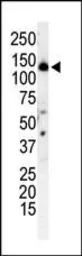 Anti-PI3 kinase p150 antibody used in Western Blot (WB). GTX25459