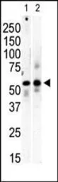 Anti-PI4K2B antibody used in Western Blot (WB). GTX25462