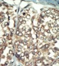 Anti-PI4K2B antibody used in IHC (Paraffin sections) (IHC-P). GTX25462