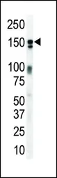 Anti-Her3 / ErbB3 antibody used in Western Blot (WB). GTX25470