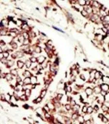 Anti-Her3 / ErbB3 antibody used in IHC (Paraffin sections) (IHC-P). GTX25470