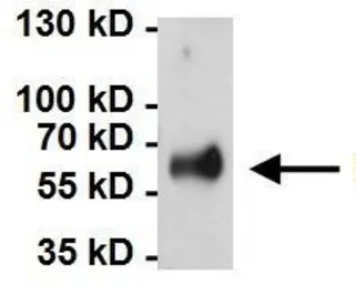 Anti-HSP60 antibody [2E1/53] used in Immunoprecipitation (IP). GTX25479