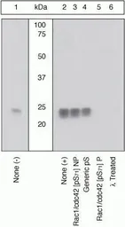 Anti-Rac1 + CDC42 (phospho Ser71) antibody used in Western Blot (WB). GTX25482