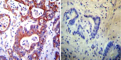 Anti-PDI antibody [RL77] used in IHC (Paraffin sections) (IHC-P). GTX25484
