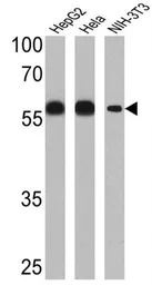 Anti-PDI antibody [RL77] used in Western Blot (WB). GTX25484