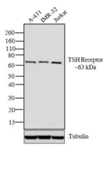 Anti-TSH receptor antibody [49] used in Western Blot (WB). GTX25492
