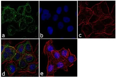 Anti-TSH receptor antibody [49] used in Immunocytochemistry/ Immunofluorescence (ICC/IF). GTX25492