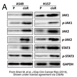 Anti-JAK1 (phospho Tyr1022/1023) antibody used in Western Blot (WB). GTX25493