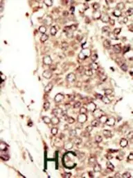 Anti-IGF1R beta antibody used in IHC (Paraffin sections) (IHC-P). GTX25497