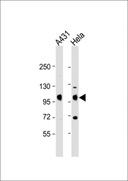 Anti-IGF1R beta antibody used in Western Blot (WB). GTX25497