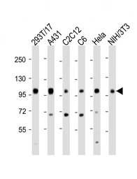 Anti-IGF1R beta antibody used in Western Blot (WB). GTX25497
