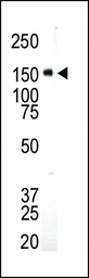 Anti-IGF1R beta antibody used in Western Blot (WB). GTX25497