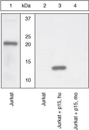 Anti-Bid (p15-specific ) antibody used in Western Blot (WB). GTX25498