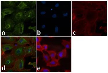 Anti-Bid (p15-specific ) antibody used in Immunocytochemistry/ Immunofluorescence (ICC/IF). GTX25498