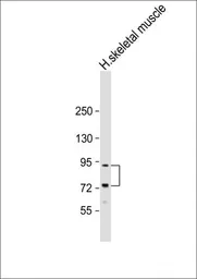 Anti-LTK antibody used in Western Blot (WB). GTX25507