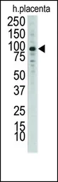 Anti-DDR1 antibody used in Western Blot (WB). GTX25508