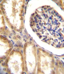 Anti-DDR1 antibody used in IHC (Paraffin sections) (IHC-P). GTX25508