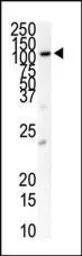 Anti-PDGF Receptor beta antibody used in Western Blot (WB). GTX25511