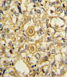 Anti-PDGF Receptor beta antibody used in IHC (Paraffin sections) (IHC-P). GTX25511