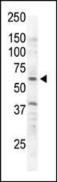 Anti-RYK antibody used in Western Blot (WB). GTX25513