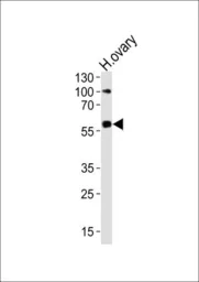 Anti-RYK antibody used in Western Blot (WB). GTX25513