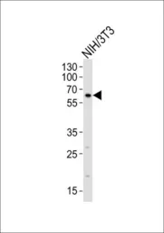 Anti-RYK antibody used in Western Blot (WB). GTX25513
