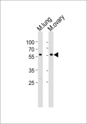 Anti-RYK antibody used in Western Blot (WB). GTX25513
