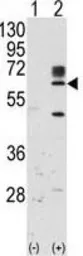 Anti-RYK antibody used in Western Blot (WB). GTX25513
