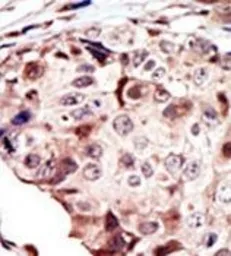 Anti-RYK antibody used in IHC (Paraffin sections) (IHC-P). GTX25513