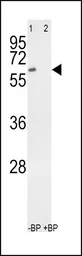 Anti-RYK antibody used in Western Blot (WB). GTX25518
