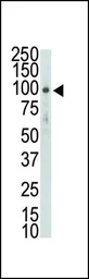 Anti-DDR2 antibody used in Western Blot (WB). GTX25520