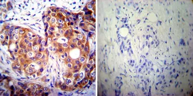 Anti-Calpastatin antibody [1F7E3D10] used in IHC (Paraffin sections) (IHC-P). GTX25582
