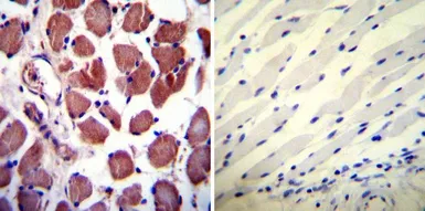 Anti-Calpastatin antibody [1F7E3D10] used in IHC (Paraffin sections) (IHC-P). GTX25582