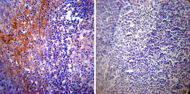 Anti-Calpastatin antibody [1F7E3D10] used in IHC (Paraffin sections) (IHC-P). GTX25582