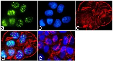Anti-IRS1 antibody used in Immunocytochemistry/ Immunofluorescence (ICC/IF). GTX25602