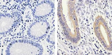Anti-MEK1 (phospho Ser298) antibody used in IHC (Paraffin sections) (IHC-P). GTX25613