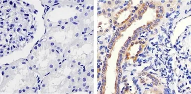 Anti-MEK1 (phospho Ser298) antibody used in IHC (Paraffin sections) (IHC-P). GTX25613