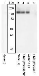 Anti-c-Kit (phospho Tyr568/Tyr570) antibody used in Western Blot (WB). GTX25616